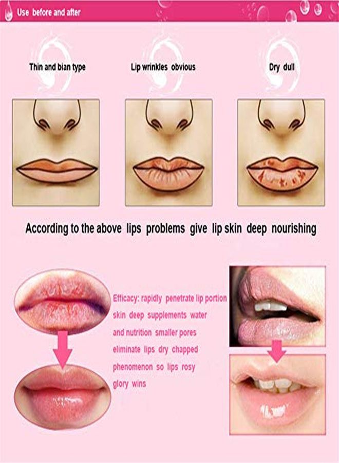 VERONNI 30 قناع شفاه مرطب جل كولاجين 24K ذهب قناع شفاه رائع لزيادة حجم الشفاه، ترطيب الشفاه، إزالة الجلد الميت، مضاد للتجاعيد، مضاد للتشقق - Image 4