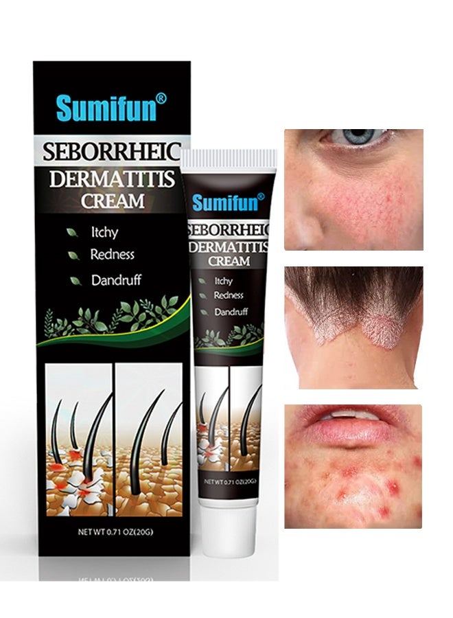 سوميفون كريم التهاب الجلد السبوري، يهدئ الحكة، يقلل من الاحمرار والالتهاب، يعالج القشرة والتهاب الجلد السبوري، كريم العناية بفروة الرأس - 20g - Image 1