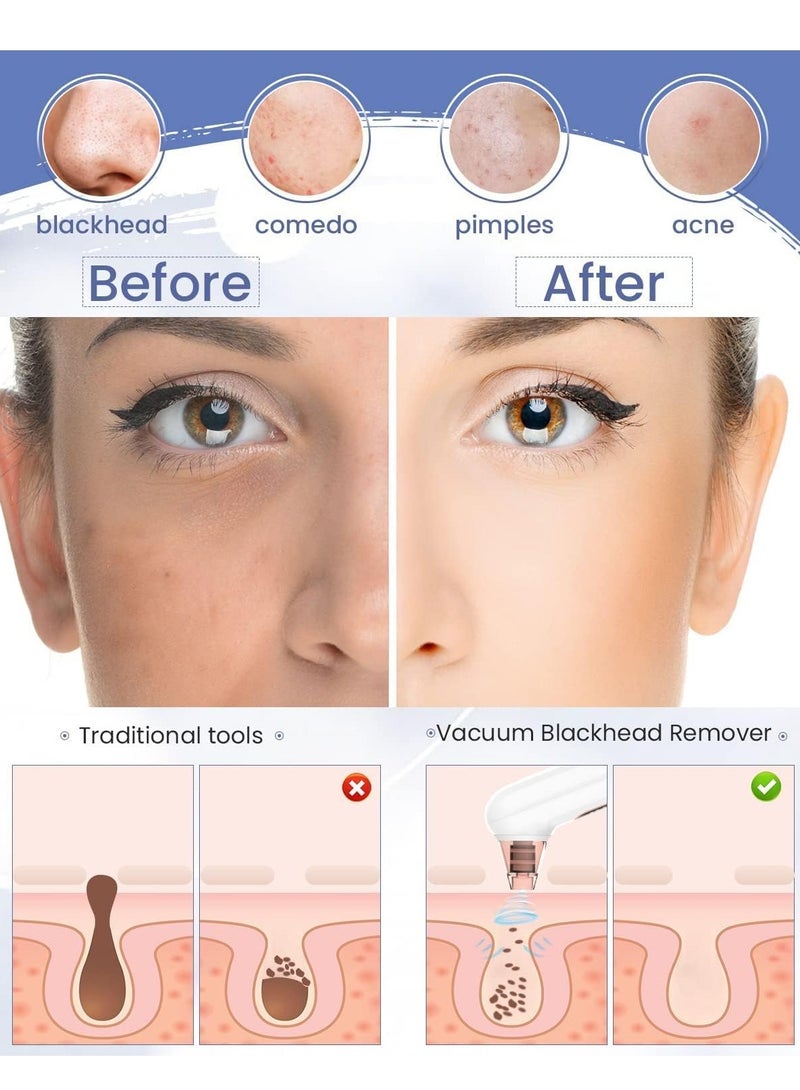 أدوات إزالة الرؤوس السوداء، مكنسة مسام الرؤوس السوداء: منظف مسام الوجه الكهربائي 3 مستويات شفط، مستخرج حب الشباب والبثور القابلة لإعادة الشحن للعناية بالبشرة للأنف والوجه (أبيض) - Image 2