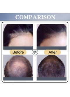 SAUVASINE Minoxidil Hair Spray, Hair Growth Serum, Extra Strength Hair Loss Treatments for Thicker Fuller Hair, Stimulates Hair Newborn, Restores Thinning Hair 30ml  - Image 4
