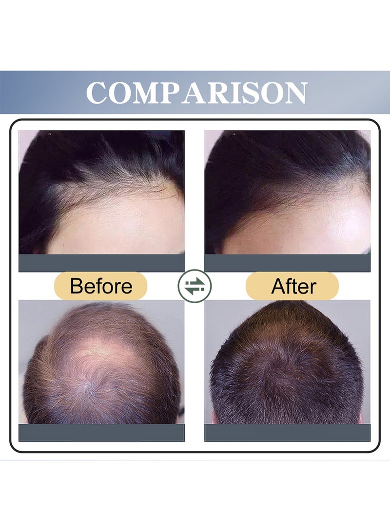 SAUVASINE Minoxidil Hair Spray, Hair Growth Serum, Extra Strength Hair Loss Treatments for Thicker Fuller Hair, Stimulates Hair Newborn, Restores Thinning Hair 30ml  - Image 4