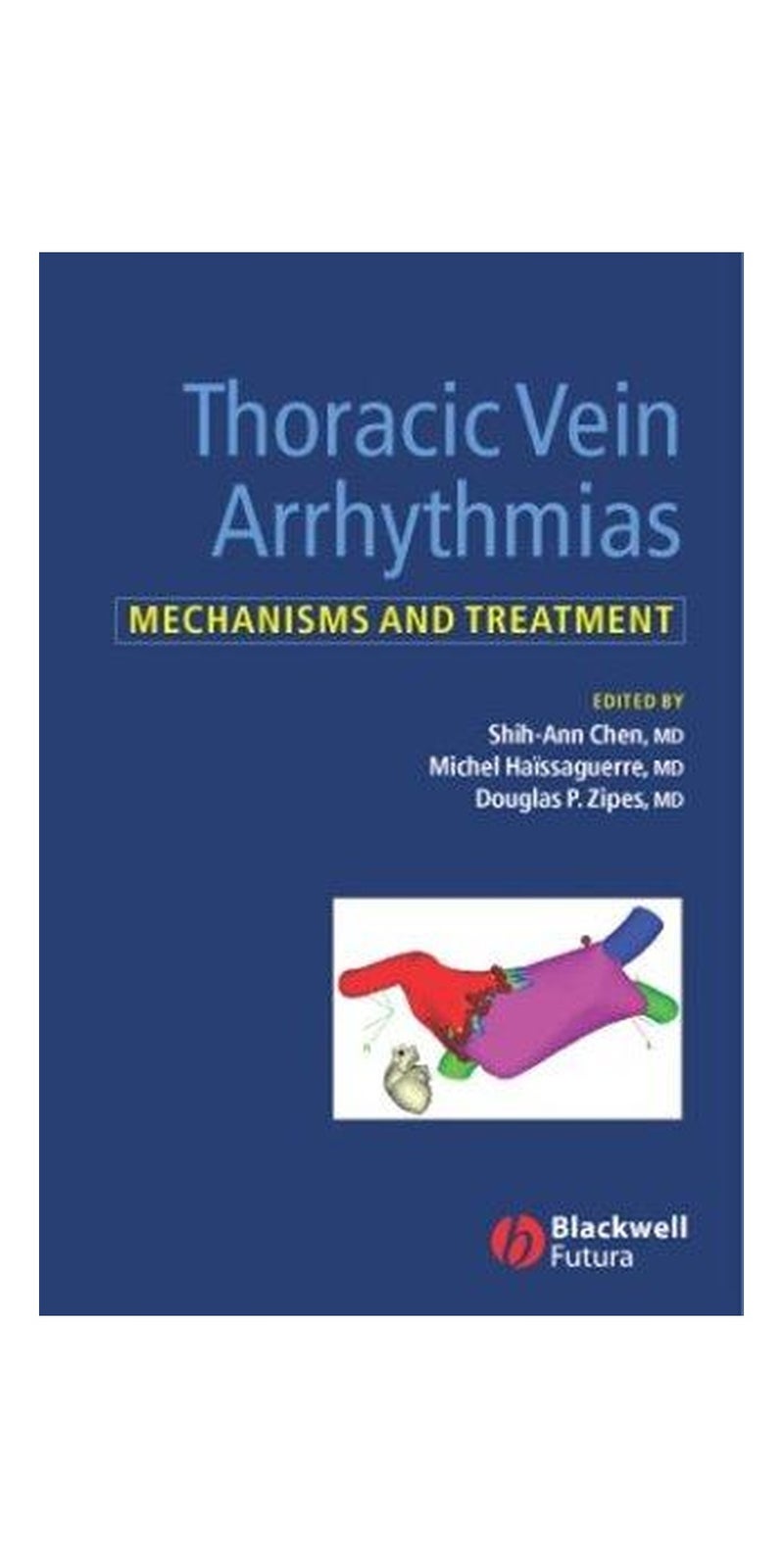 Thoracic Vein Arrhythmias: Mechanisms and Treatment | Authored by Michel Haissaguerre, Douglas Zipes | Hardcover | Published by Blackwell Publishing Limited