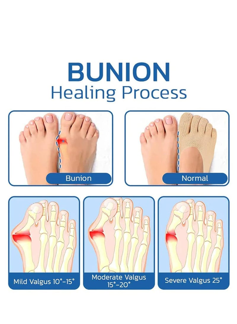5 Pairs Sock Align Toe Socks for Bunion, Yoga Socks Women Running Socks.