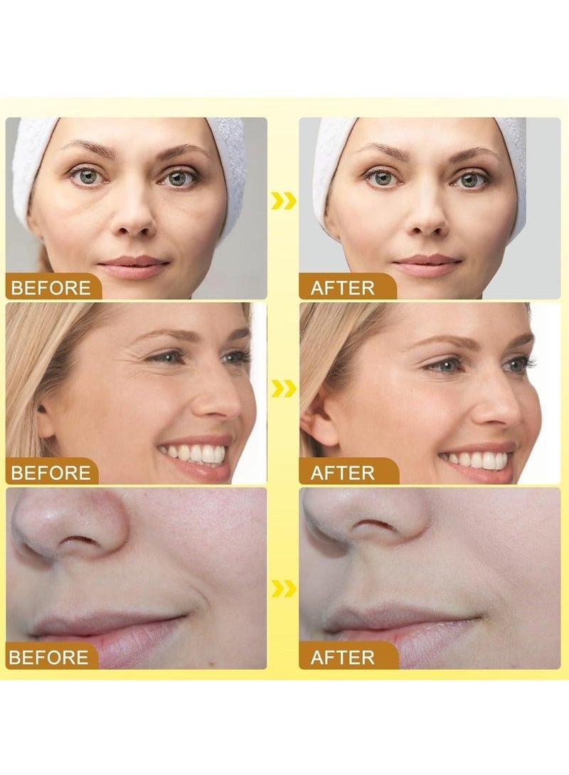 OUHOE 3Pcs Botox Bee Venom Cream Wrinkle Removal & Firming,Moisturizing,Lifting & Recovery for All Skin Type,Anti-Aging Bee Venom Cream,Face Cream Moisturiser - Image 4