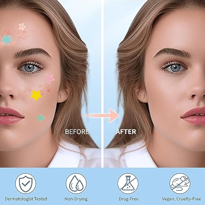 QUSTERE Pimple Patches for Face, Hydrocolloid Acne Patches, Cute Star Zit Covers, Colorful Spot Stickers with Tea Tree, Salicylic Acid & Cica Oil| 3 Sizes (10mm, 12mm & 14mm) |200 Count - Image 4