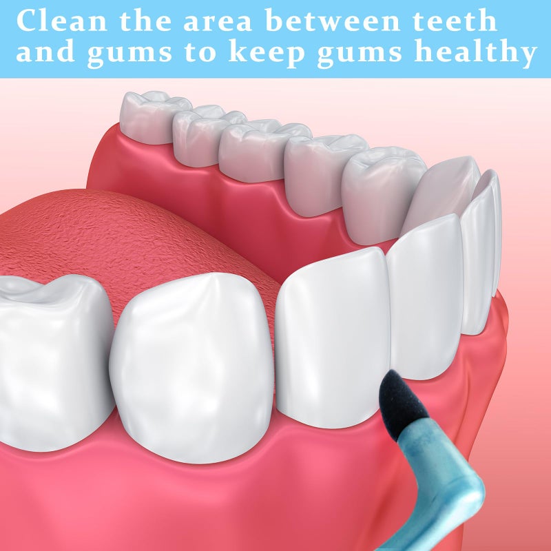 Tondiamo 10 Pcs Gum Stimulator Dental Tools Dental Plaque Remover Rubber Tip Stimulator for Cleaning Teeth Tartar - Image 4