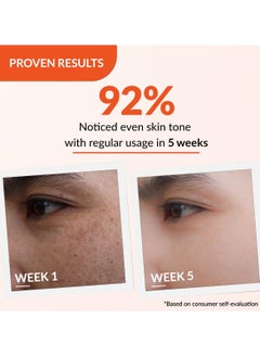 FIXDERMA Tranexamic Acid + 2% Kojic Acid + 1% Arbutin SKARFIX -TX Face Cream | Pigmentation Removal Cream | Kojic Acid Cream | Uneven Skin Tone - 30 gm  - Image 4