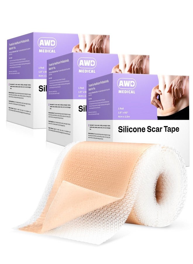 AWD Medical Silicone Scar Sheets for Surgical Scars - Silicone Scar Tape for C Section, Tummy Tuck Tape, Keloid Treatment - Silicone Skin Patches After Surgery Must Haves (1.6" x 60" Roll, Pack of 3) - Image 1