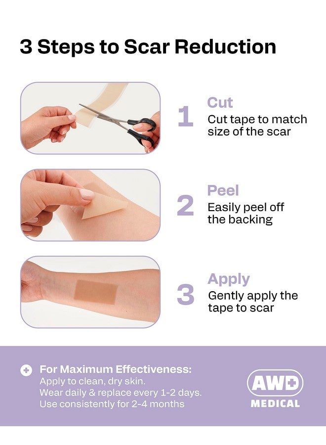 AWD Medical Silicone Scar Sheets for Surgical Scars - Silicone Scar Tape for C Section, Tummy Tuck Tape, Keloid Treatment - Silicone Skin Patches After Surgery Must Haves (1.6" x 60" Roll, Pack of 3) - Image 3