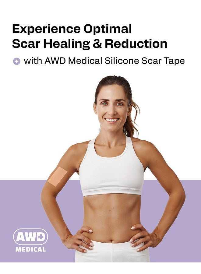 AWD Medical Silicone Scar Sheets for Surgical Scars - Silicone Scar Tape for C Section, Tummy Tuck Tape, Keloid Treatment - Silicone Skin Patches After Surgery Must Haves (1.6" x 60" Roll, Pack of 3) - Image 2