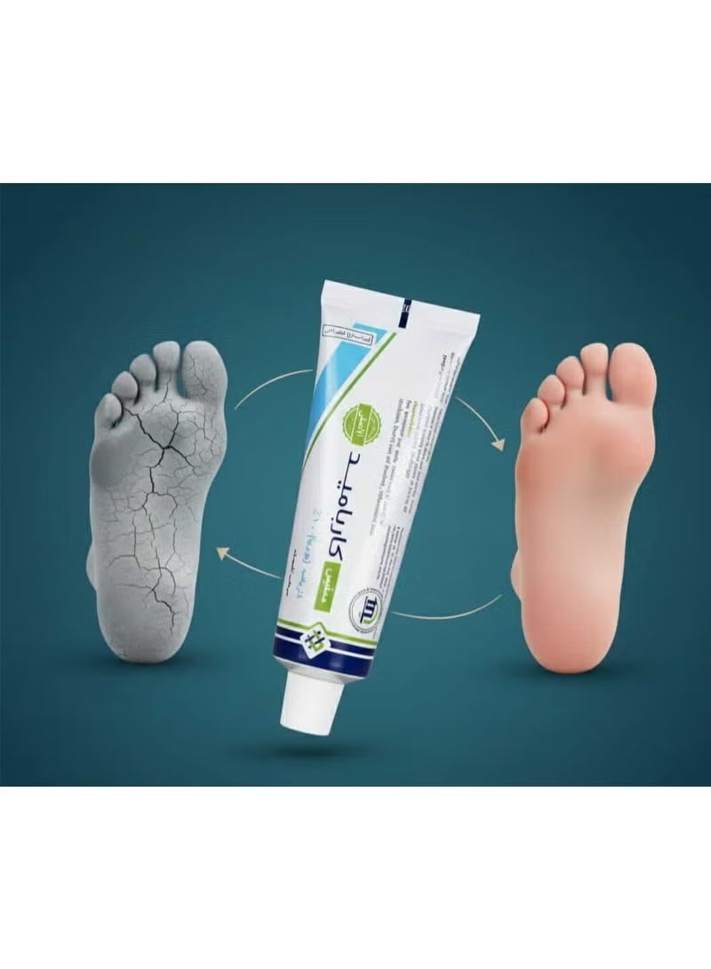 Memphis Carbamide Cream 30g with 10% Urea for moisturizing and treating cracked feet and body, for treating severe dryness, psoriasis, and keratosis pilaris (chicken skin). - Image 2