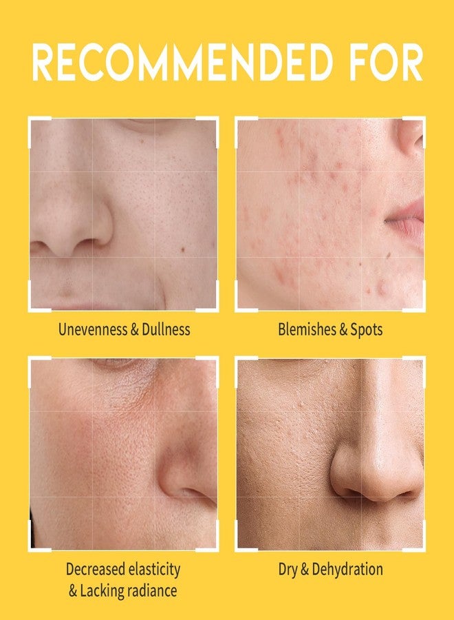 #OOTD تونر فيتامين سي للوجه - تركيبة غنية بالنياسيناميد، ومستخلص أوراق القلب، والسكوالين - 8.45 أونصة سائلة - Image 5