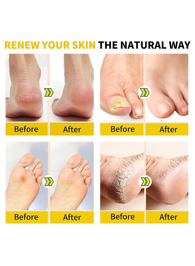 Sefudun 2 Packs 20PCS Herbal Foot Cleaning Soak Beads, Herbal Body Detox Foot Soak, Foot Spa Pedicure With Bath Salt, Foot Cream, Foot Scrub, Natural Herbal Foot Massage Beads For Men And Women  - Image 4