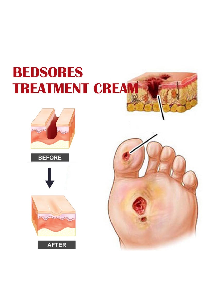 EELHOE Bedsore Repair Cream, Wound Healing Ointment, Fast-Acting Bedsore Cream, Rapid Wound Healing Gel, Bedsore Wound Care, Pressure Sore Relief Cream 20g - Image 3