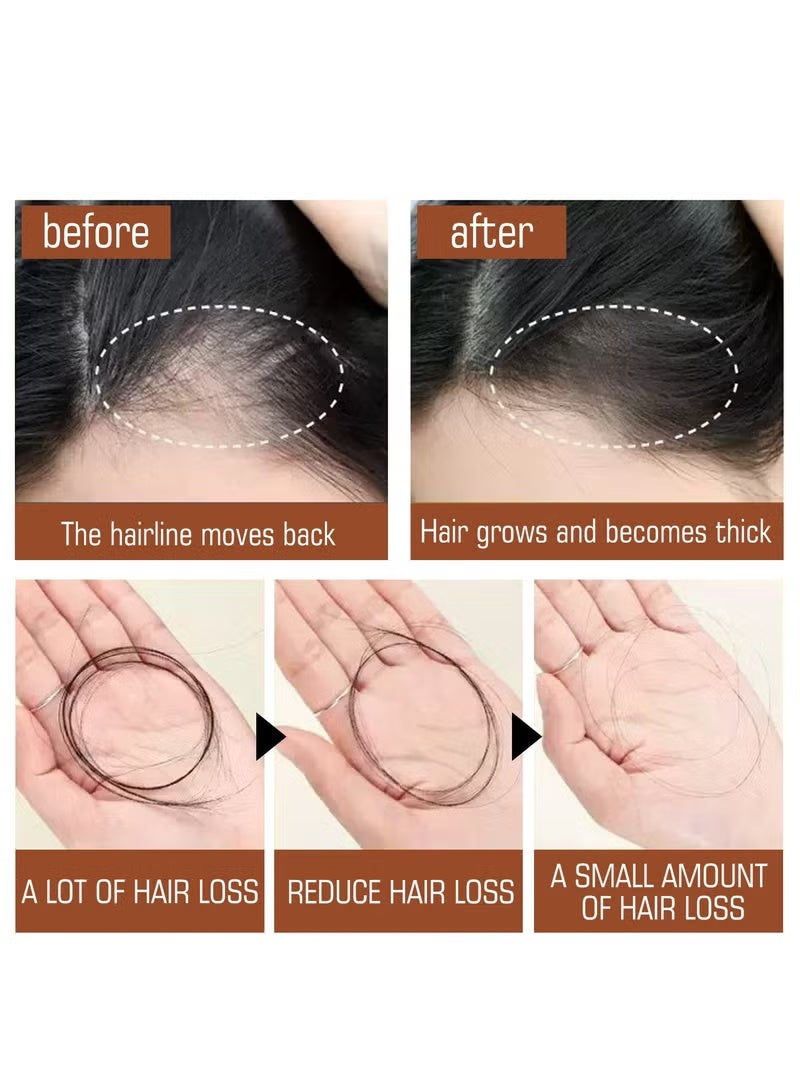 EELHOE Batana Oil for Hair Growth Healthier Thicker Fuller Hair, Batana oil, Batana Oil for Hair Growth, Batana Oil Organic, Batana Oil Organic for Healthy Hair, Batana Oil Hair Mask (1PCS) - Image 2