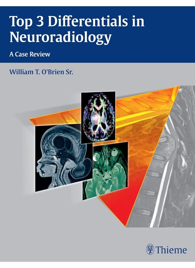 Top 3 Differentials in Neuroradiology 