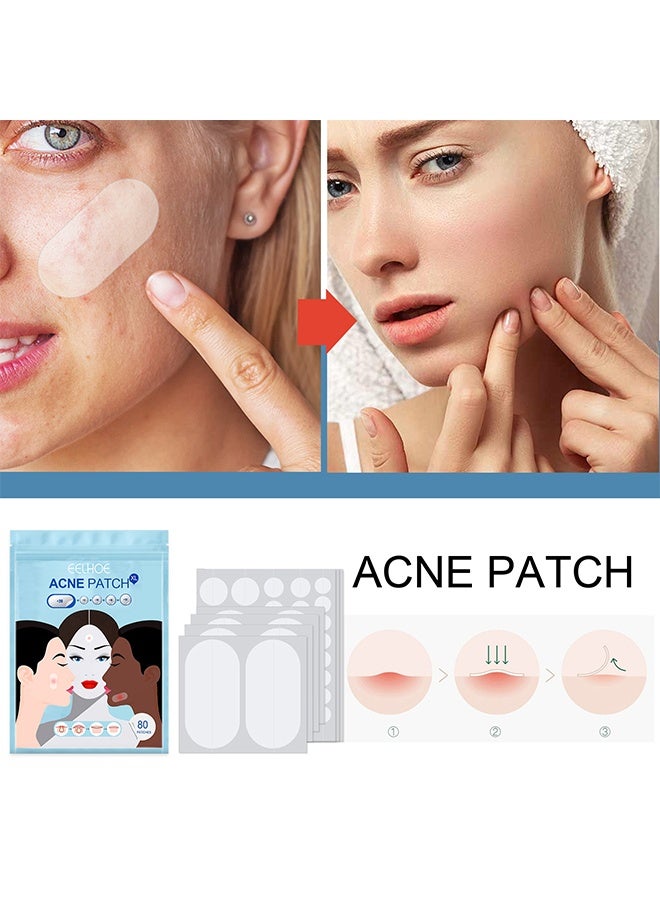 EELHOE Acne Patch - 5 Sizes Of Patch Healing Acne And Pustule Can Be Used Day And Night , Acne patch can be made up IOnvisible Acne-Clearing Anti-acne-Closing Acne Waterproof Concealer Hydrocolloidal Acne Patch 80 Patches - Image 2
