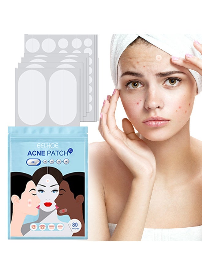 EELHOE Acne Patch - 5 Sizes Of Patch Healing Acne And Pustule Can Be Used Day And Night , Acne patch can be made up IOnvisible Acne-Clearing Anti-acne-Closing Acne Waterproof Concealer Hydrocolloidal Acne Patch 80 Patches - Image 1