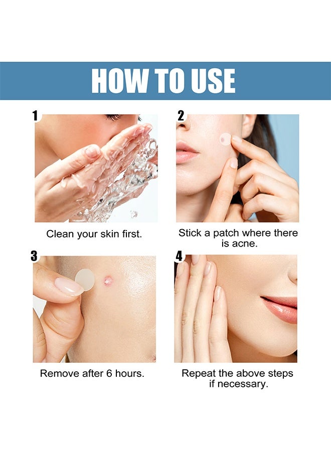 EELHOE Acne Patch - 5 Sizes Of Patch Healing Acne And Pustule Can Be Used Day And Night , Acne patch can be made up IOnvisible Acne-Clearing Anti-acne-Closing Acne Waterproof Concealer Hydrocolloidal Acne Patch 80 Patches - Image 5