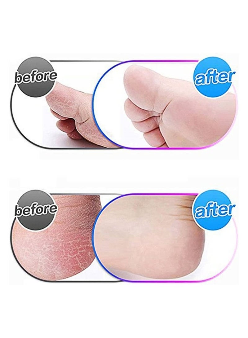 سيوسي أسطوانة استبدال مبرد القدم الإلكترونية، 5 قطع من عبوات إزالة الجلد الصلب للباديكير، أدوات العناية بالقدم، أسطوانة بديلة خشنة - Image 4