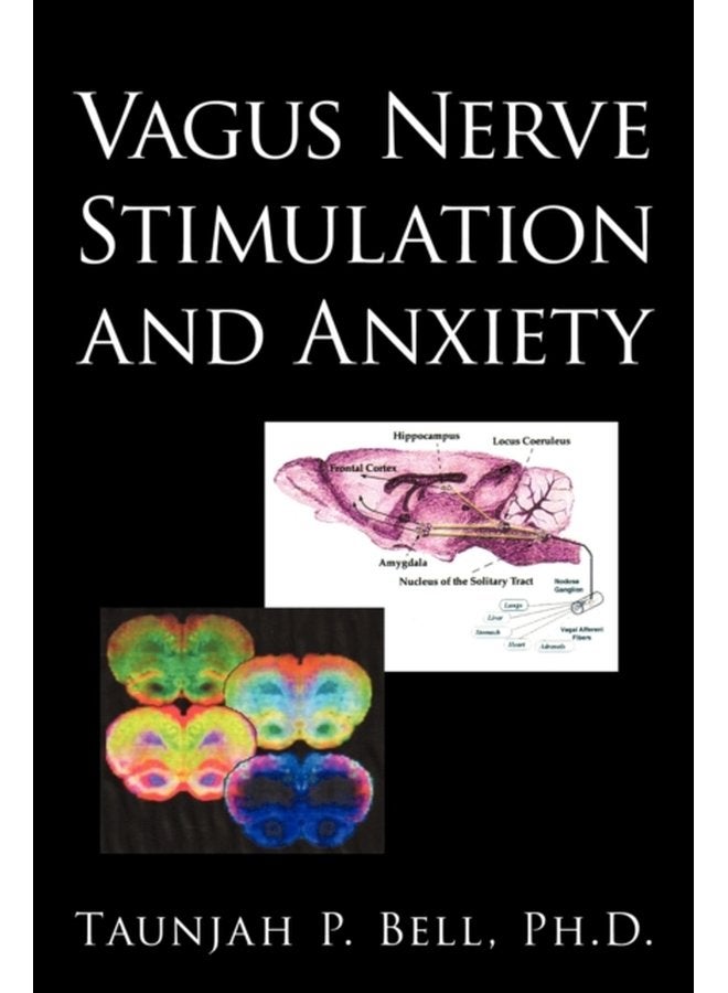 Vagus Nerve Stimulation and Anxiety - Paperback