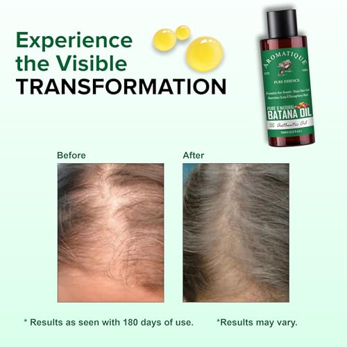 Aromatique Batana Oil | 100% Pure & Cold Pressed from Honduras | Natural Palm Nut sourced for Hair, Scalp & Skin Nourishment | 100ml - Image 4