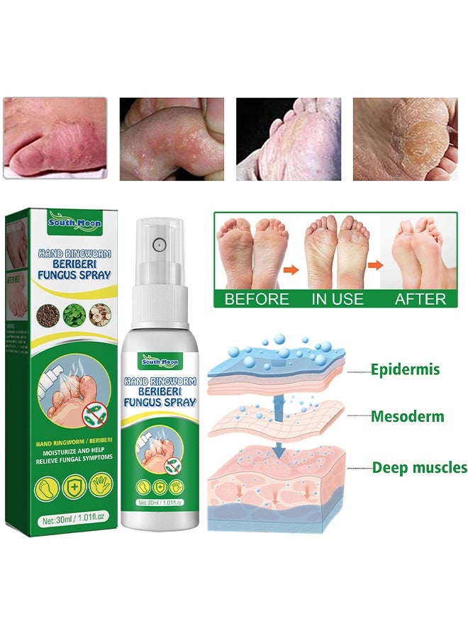SOUTH MOON Hand Ringworm BeriBeri Fungus Spray, Anti-Fungi Treatment For Feet Itchy, Sweating, Peeling And Blisters, Natural Ingredients Foot Fungi Spray For Tinea Pedis, Inflamed, Feet Smelly 30ML - Image 4