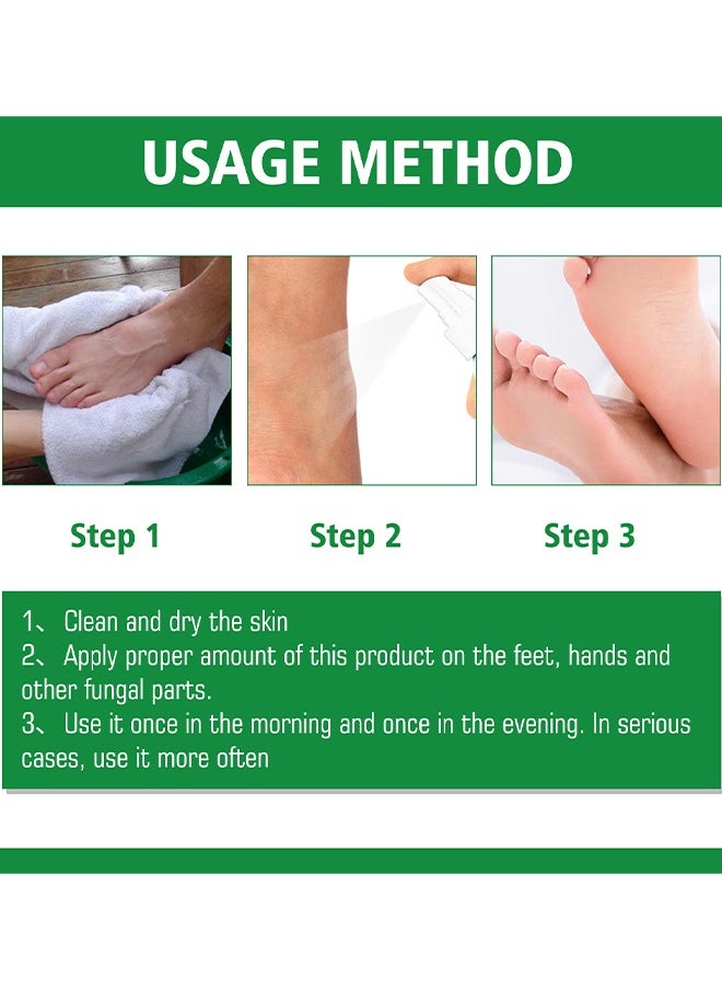 SOUTH MOON - Hand Ringworm BeriBeri Fungus Spray, Anti-Fungi Treatment For Feet Itchy, Sweating, Peeling And Blisters, Natural Ingredients Foot Fungi Spray For Tinea Pedis, Inflamed, Feet Smelly 30ML - Image 1