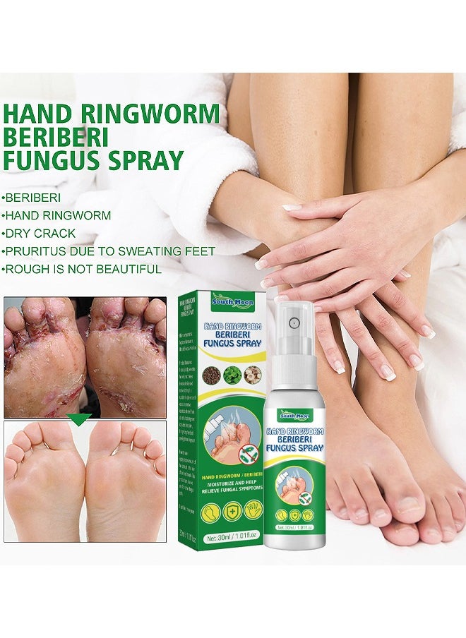 SOUTH MOON - Hand Ringworm BeriBeri Fungus Spray, Anti-Fungi Treatment For Feet Itchy, Sweating, Peeling And Blisters, Natural Ingredients Foot Fungi Spray For Tinea Pedis, Inflamed, Feet Smelly 30ML - Image 1