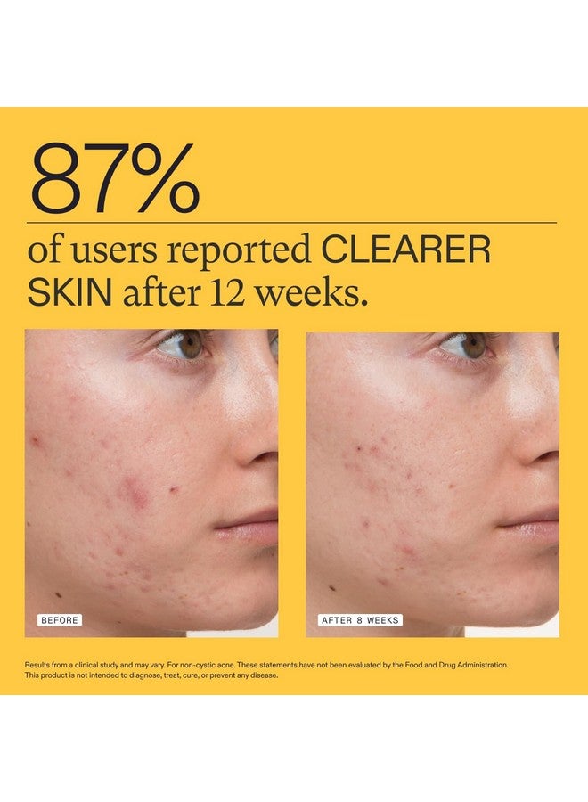 NUTRAFOL Nutrafol Clear Skin Acne Supplement for Women, Clinically Tested for Clearer, Smoother Skin, Physician-Formulated, Vegan - 1-Month Supply  - Image 4