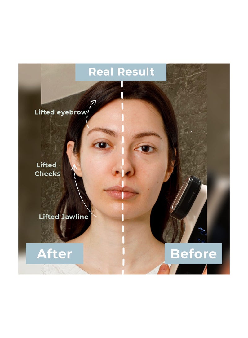 XiuWoo Radio Frequency Skin Tightening Machine,6-in-1 Rechargeable Anti-Aging Care Microcurrent Facial Device, Red Light, Wrinkle Remove, Rejuvenation, Skin-Firming, Coal Black and Pearl White - Image 4