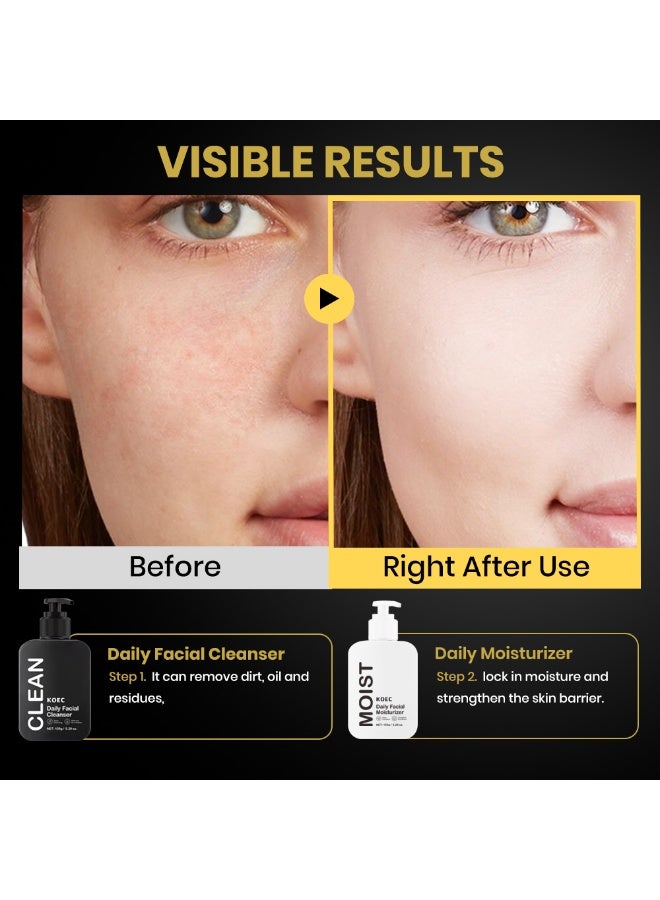 ك أو إي سي مرطب الوجه اليومي 150g -الترطيب العميق و حاجز الجلد تعزيز مع بانثينول، سكوالان و حمض الغليسيرين المنعش غير مشدد Formula - Image 4