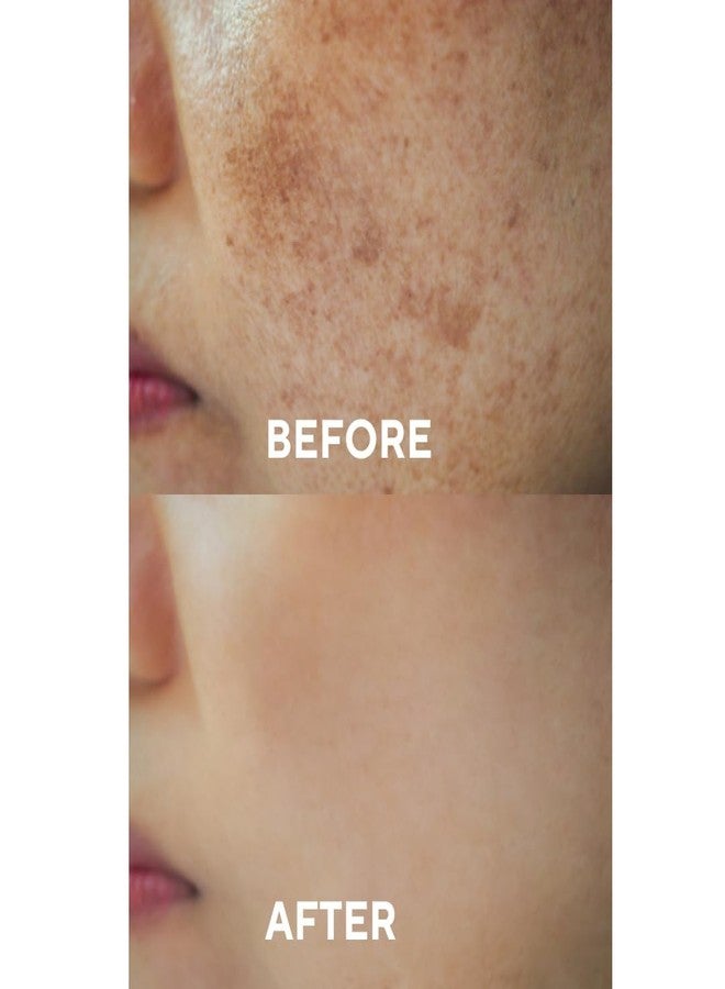 The Ceel Dark Spot Correcting Serum with Glutathione & Niacinamide – Brightening Facial Serum for Uneven Skin Tone, Hyperpigmentation & Dark Spots – Lightweight Face Serum – 30ml - 1.0 fl.oz - Image 4