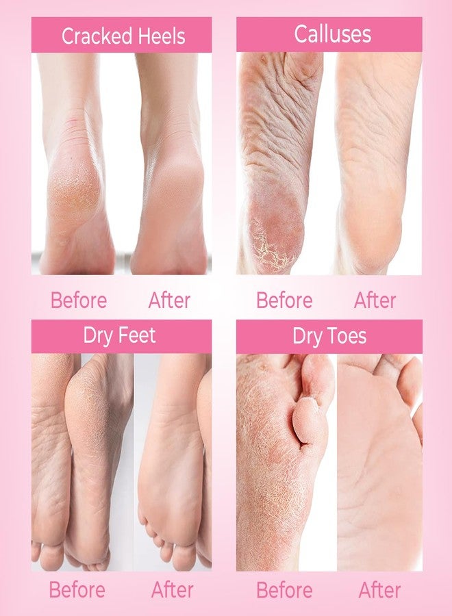 SAISZE Foot Peel Mask, Lavender, 4 Pairs - Image 2