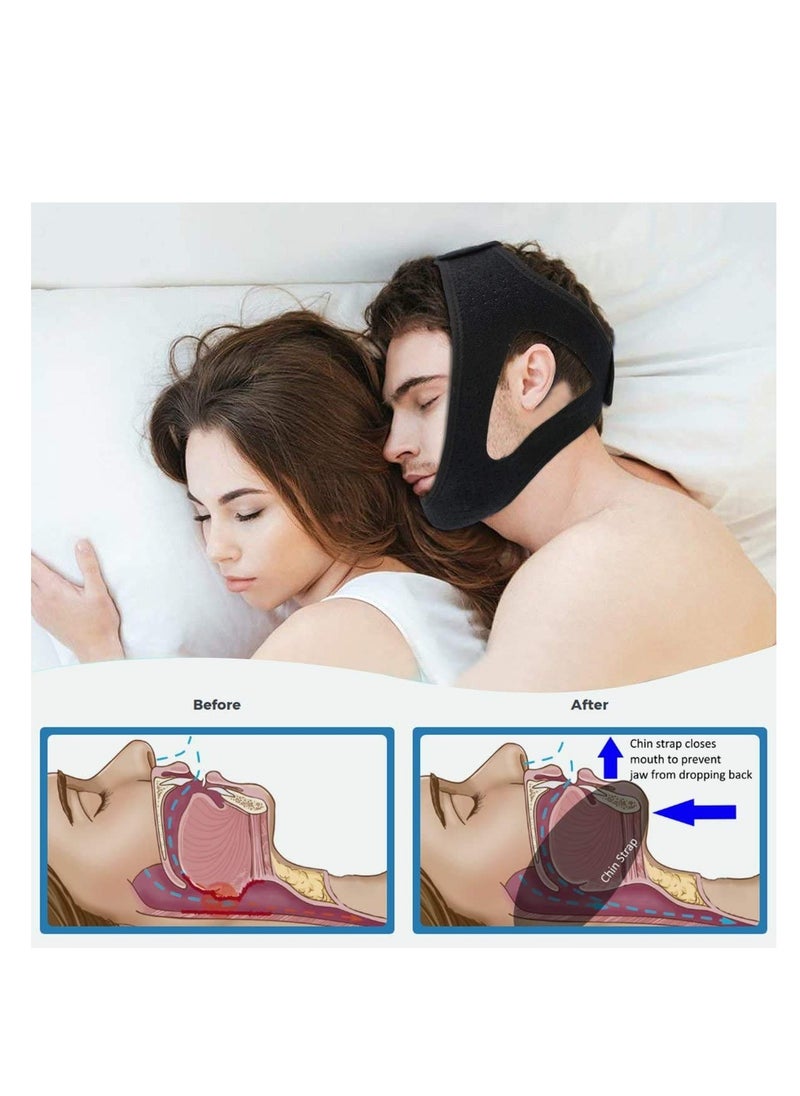 SYOSI Anti Snoring Chin Strap, Stop Snoring, The Most Effective Snoring Solution, Snoring Reduction Relief Stopper, Sleep Aid Devices Adjustable Comfortable Bands For Men And Women  - Image 4