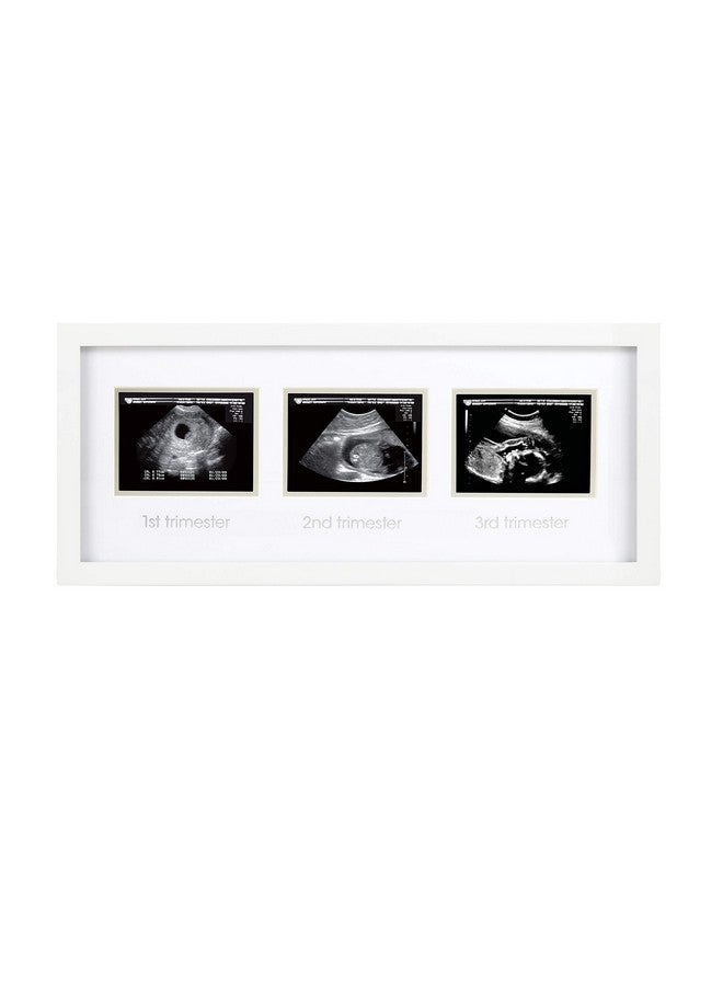 pearhead Trimester Progression Sonogram Picture Frame Pregnancy Milestone Keepsake Photo Frame Sonogram Keepsake Genderneutral Baby Nursery Décor - Image 2