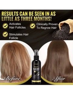 ELBBUB 120ml Organic Black Rice Water Spray with Castor Oil Biotin for Hair Growth Hair Regrowth Treatment for Thicker Fuller Hair Growth Hair Growth Serum Rice Water Spray for Damaged Hair  - Image 4