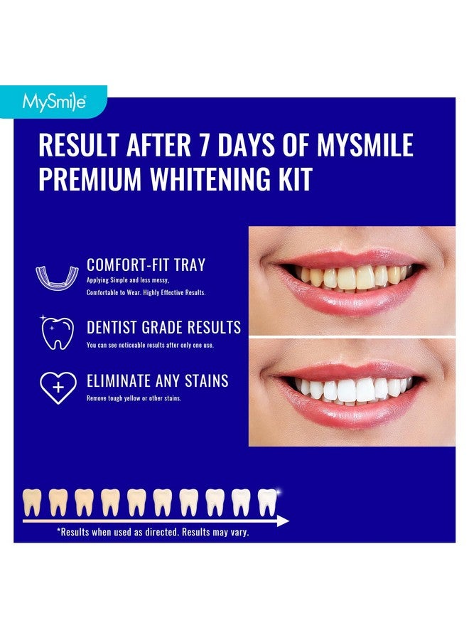 MySmile Prefilled Teeth Whitening Kit For Sensitive Teeth, 12% Hydrogen Peroxide Teeth Whitening Gel Trays, One-Step Fast Teeth Whitener, Help Remove 20 Years Of Stains, 14 Trays -7 Day Treatments. - Image 2