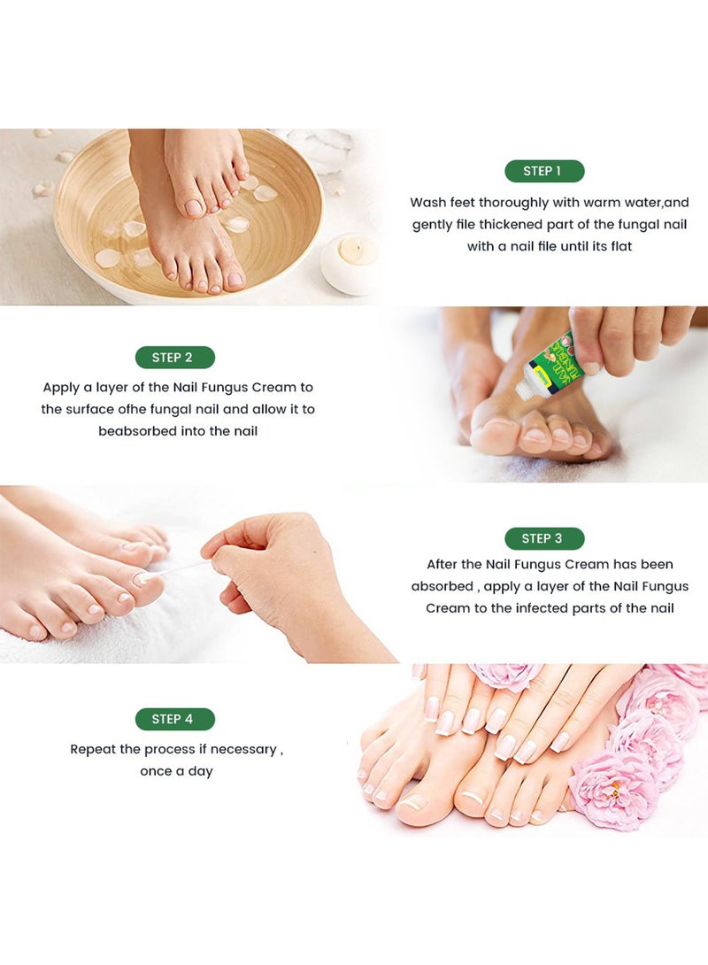 سوميفون كريم فطريات الأظافر، كريم إصلاح الأظافر بقوة إضافية، كريم علاج فطريات أظافر القدم، ينظف ويبيض وينعم الأظافر، ويصلح البكتيريا 30 جم - Image 5