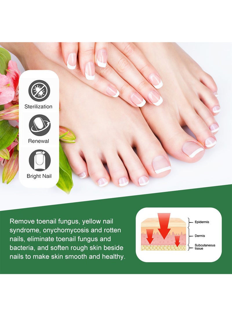 سوميفون كريم فطريات الأظافر، كريم إصلاح الأظافر بقوة إضافية، كريم علاج فطريات أظافر القدم، ينظف ويبيض وينعم الأظافر، ويصلح البكتيريا 30 جم - Image 2