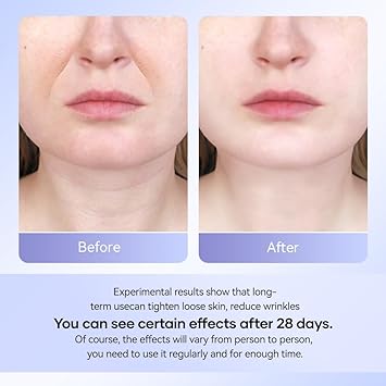 ANLAN Face Massager AntiWrinkle Face Device with 3 Modes 45C for SkinTightening Neck Lifting EMS Massage Face Toning Firming for Women - Image 4