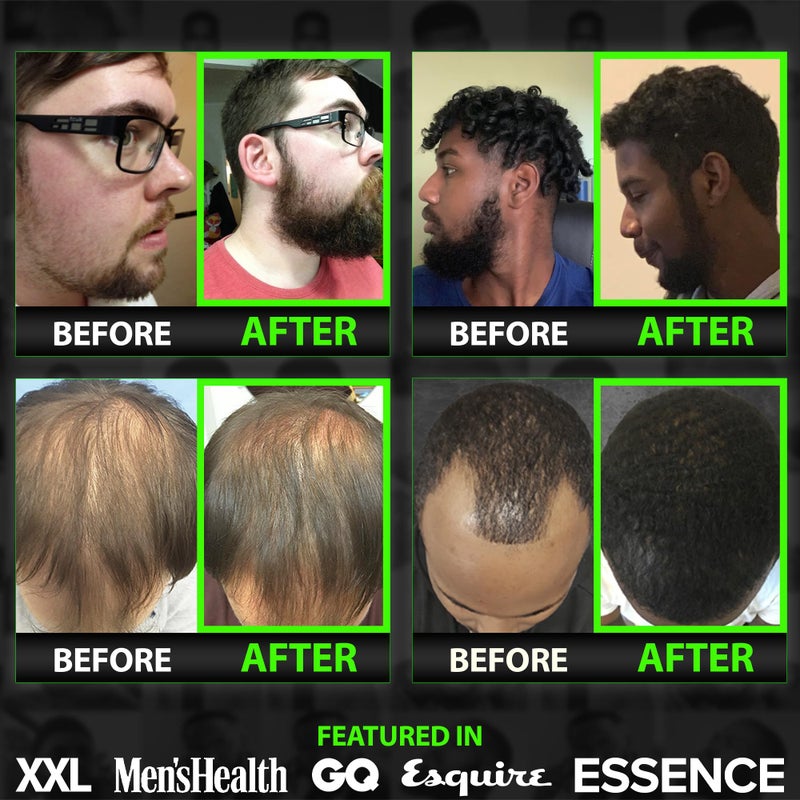 BBS BEST BEARD STUFF زيت نمو الشعر واللحية GROW ماكس XXL للرجال • سيروم نمو اللحية الذي يملأ البقع ويصلح الترقق مضمون • علاج للشعر واللحية • مكثف ومُعزز • مصنوع في الولايات المتحدة الأمريكية - Image 5