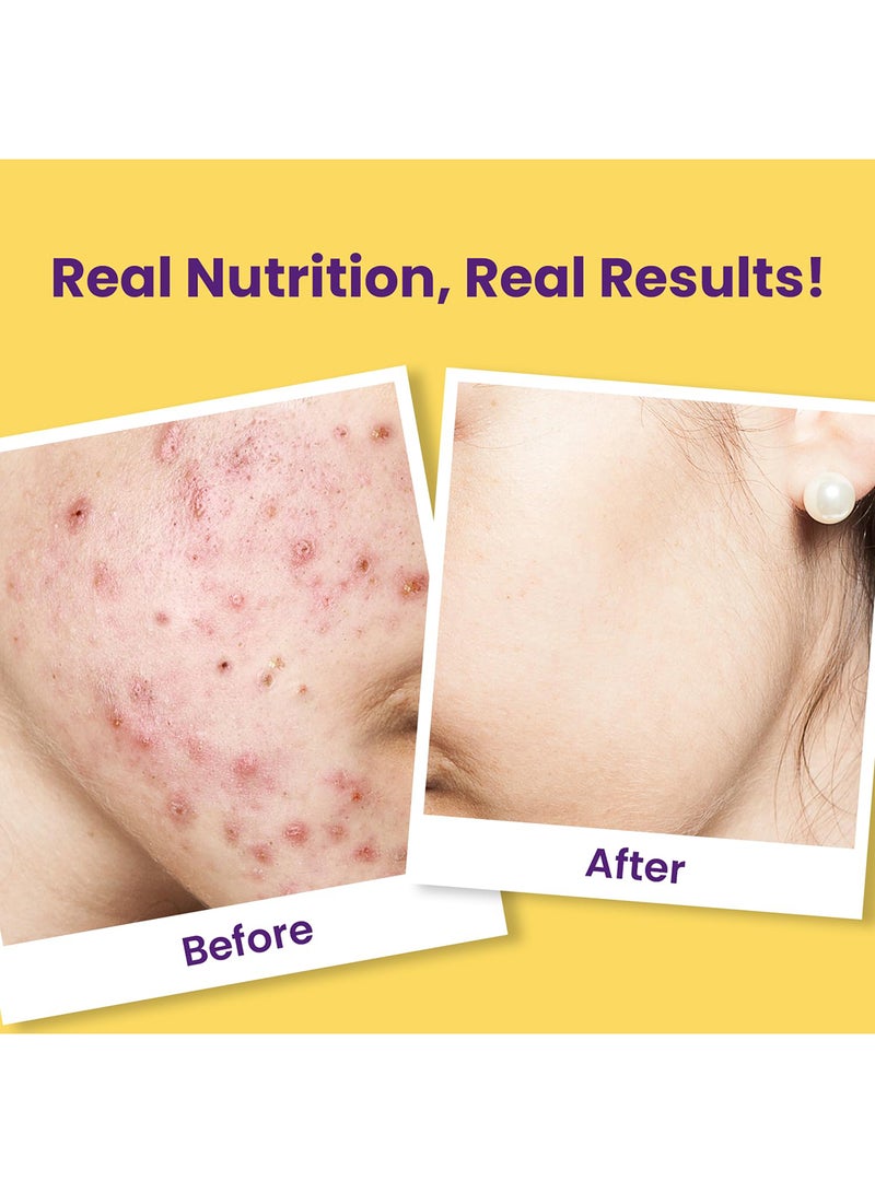 CHICNUTRIX Super C Acne Free Clear Skin - Image 4