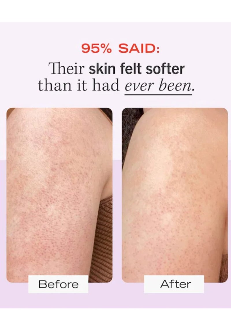 First Aid Beauty مقشر الجسم من فيرست أيد بيوتي لإزالة نتوءات KP مع 10% AHA، 56.7 جرام - Image 4