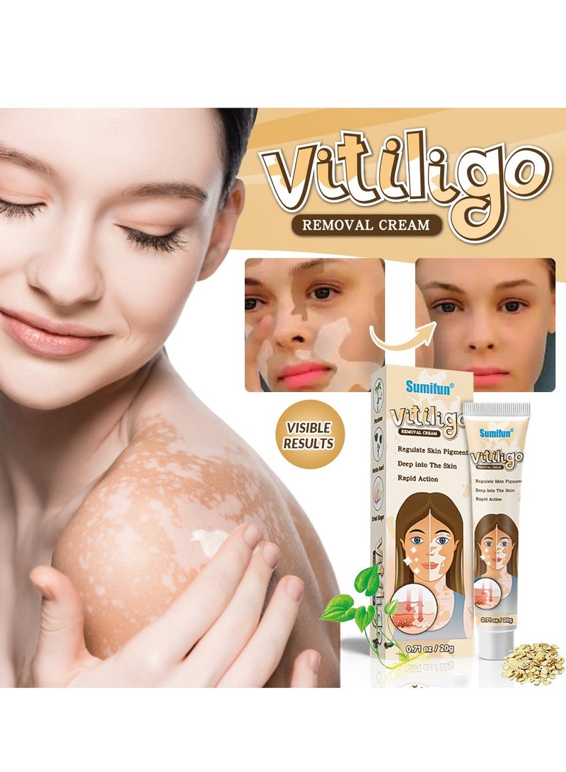Sumifun Supwell Vitiligo Cream, Vitiligo Treatment for Skin Vitiligo, Vitiligo Care Cream for Reduce White Spots and Improve Skin Pigmentation - Image 4