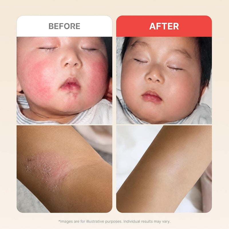 أتوبالم MLE Eczema Cream 2.2 Fl Oz, Premium Baby Face and Body Moisturizer for Skin Barrier, Daily Long-lasting Moisturizing Facial Cream for Relieving Itchiness & Redness, Gentle Baby Skincare - Image 5