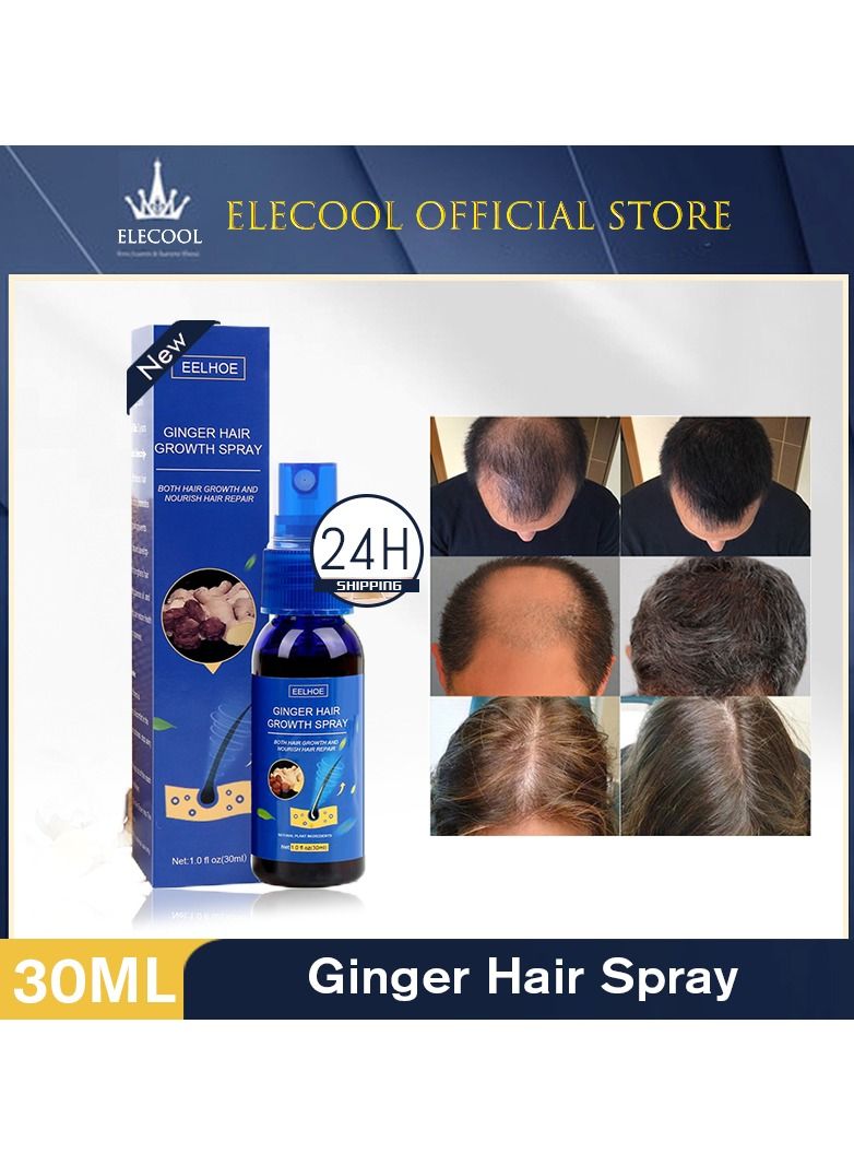 EELHOE Ginger Hair Grower spray Anti Hair Fall Hair Loss Treatment Hair Growth Essence Oil for Men Women - Image 5