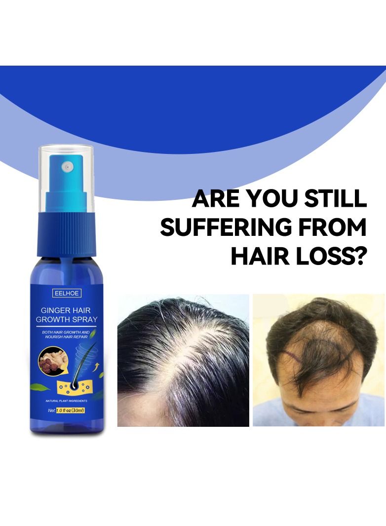 EELHOE Ginger Hair Grower spray Anti Hair Fall Hair Loss Treatment Hair Growth Essence Oil for Men Women - Image 4