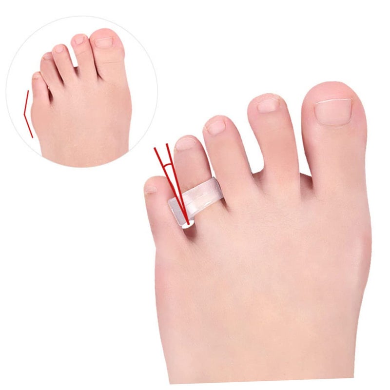 Balanced structure Ipetboom 3 Pairs Bunion Silicone Toe Separators for Foot Alignment Gel Spacers for Overlapping and Hammer Toes Suitable for Men and Women Nationwide delivery Tiered purchase options Proper storage environment Quick assemble Wet anti slip Labor saving optimized design Long term use design Most item matching trendy design No overseas transit wait Chemical free Flexible varied design Advanced compact design Multi-use well optimized build Simple practical structure Confirmed available stock Multiple design variants Economical varied sizing picks All temp range compatible build Market need oriented construction Bulk storage easy optimized build Regular scheduled transit Practical build Storage transit efficiency build Anti slip - Image 4