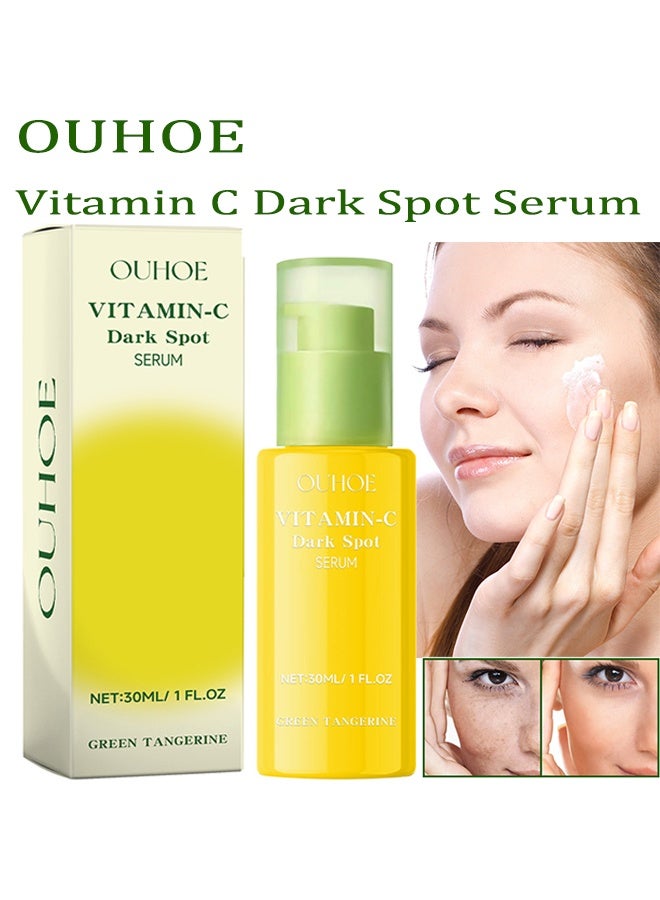 OUHOE Vitamin C Dark Spot Serum,Niacinamide Acid Help Fade Sun Spots And Dark Spot,For Face & Neck And Eye Care Organic Anti-Aging Serum (30ml) - Image 1